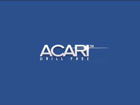 Acari Talon Install Video